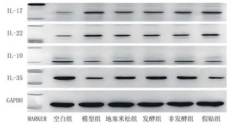 空白組和支氣管哮喘各組大鼠肺組織中IL－17、IL－22、IL－10、IL－35蛋白表達(dá)電泳圖